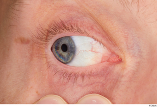 Stanley Johnson eye 0008.jpg